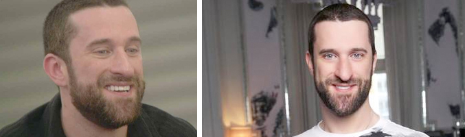 Dustin Diamond, el mítico Samuel "Screech" Powers de 'Salvados por la campana'