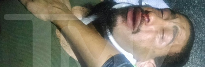 Imagen del presunto agredido por Columbus Short