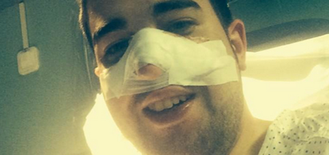 Dámaso Angulo ('GH12') se recupera tras ser operado de cáncer de piel