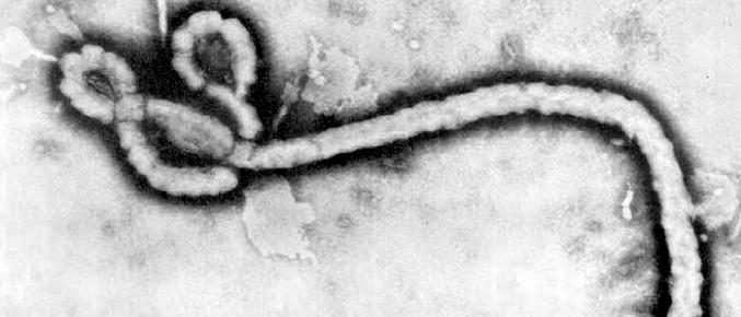 Imagen del virus del Ébola visto en el microscopio electrónico