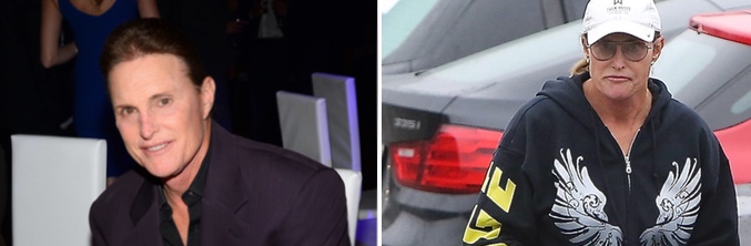 Bruce Jenner antes y después de su última operación