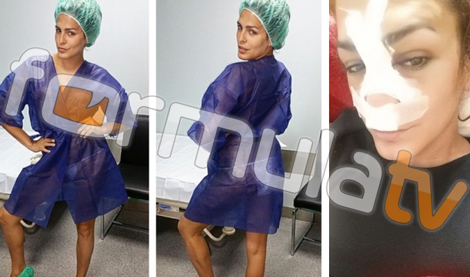 Amor Romeira, tras la operación al estilo Kim Kardashian