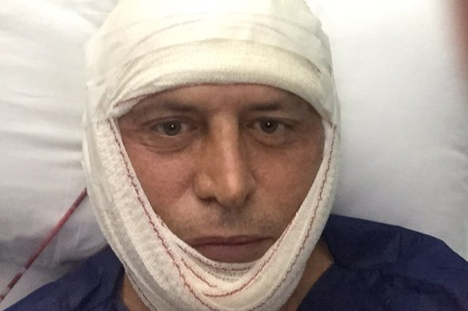 Kiko Matamoros tras la operación