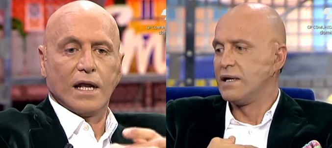 kiko matamoros operacion resultado 2015 salvame deluxe