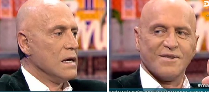 Kiko Matamoros tras la operación