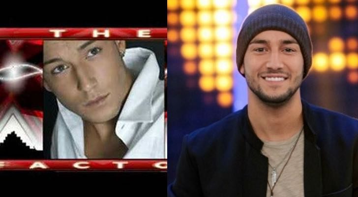 El antes y el después de Jadel