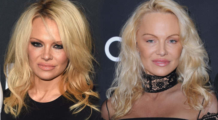 Pamela Anderson, antes y después