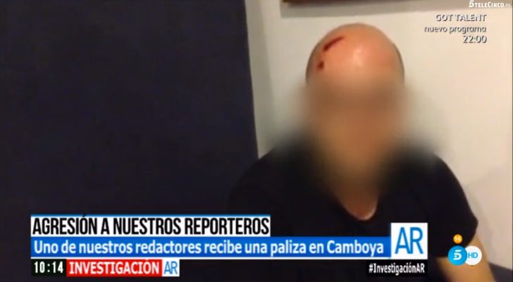 El reportero agredido enseña las brechas producidas por la paliza