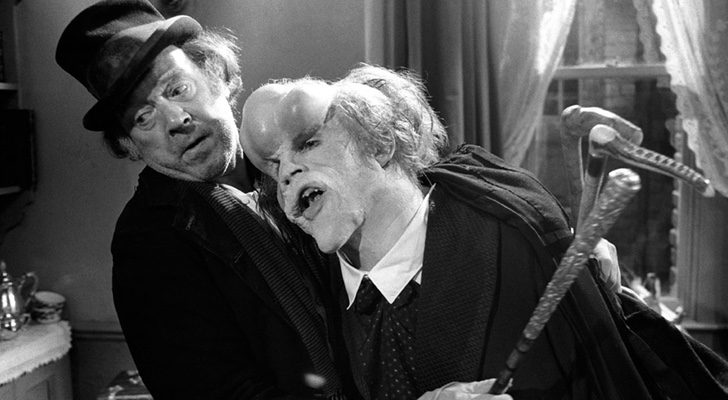 John Hurt en "El hombre elefante"