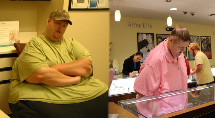 El antes y después de James, participante de 'Mi vida con 300 kilos'