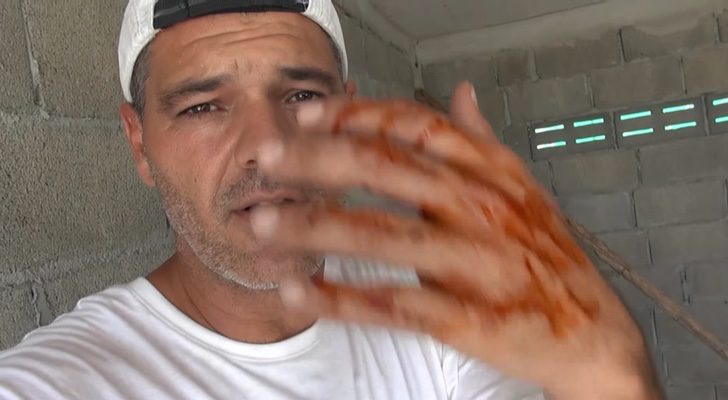 La mano de Frank Cuesta, ensangrentada tras la mordedura