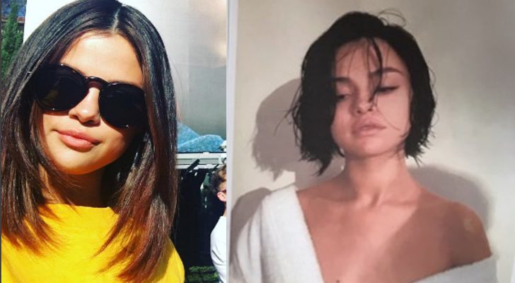 El antes y el después de Selena Gómez