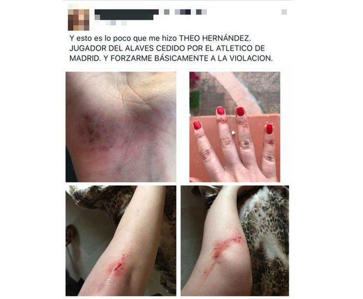 Las fotos de la presunta agresión a Luisa Kremleva