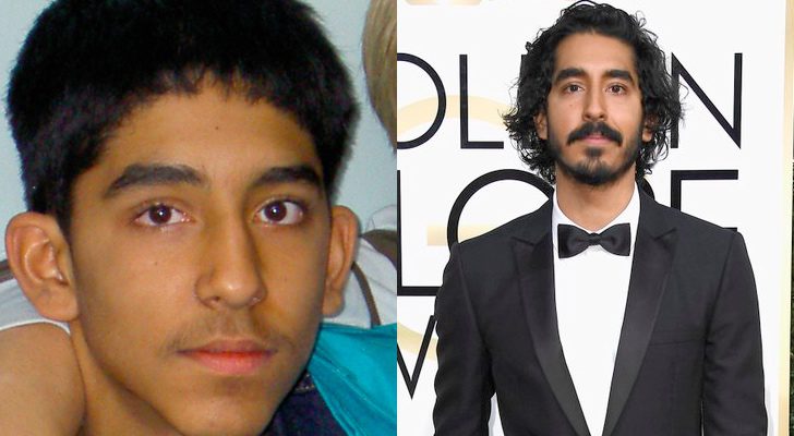 Antes y después de Dev Patel