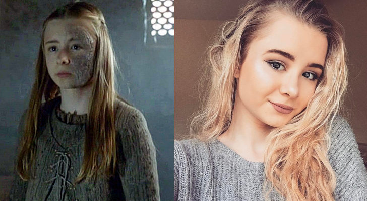 Kerry Ingram, antes y después