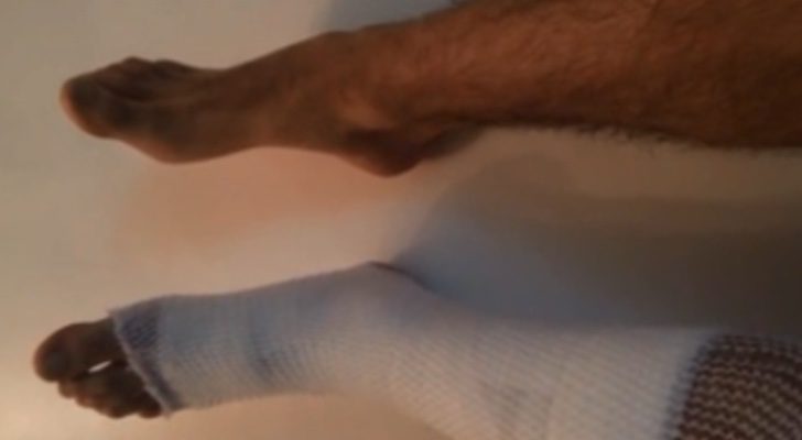 El pie lesionado de Aritz