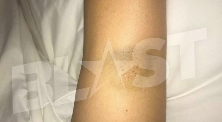 Moratones de Elsie Hewitt, exnovia de Ryan Phillippe