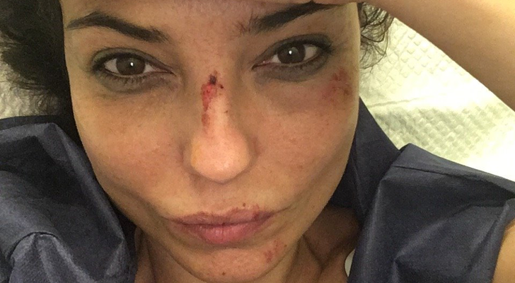 Mari Cielo con heridas en la cara