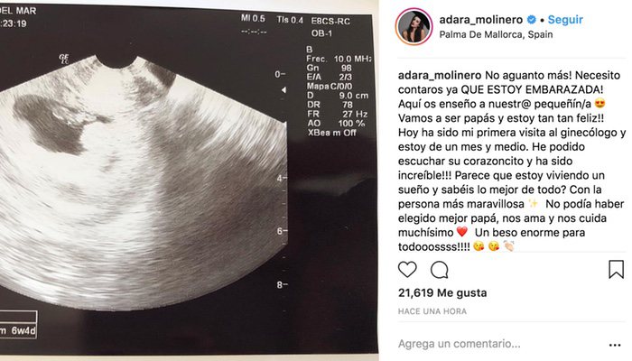 La publicación de Adara confirmando su embarazo