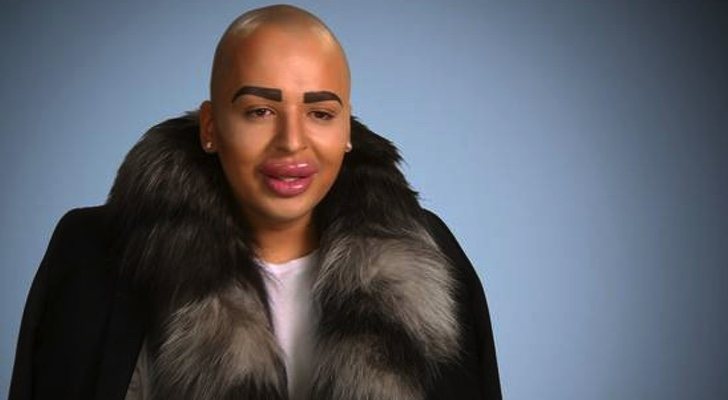 Un participante de &#39;Desastres estéticos&#39; muestra su &quot;chapuza&quot;