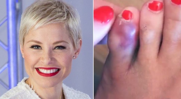 Soraya Arnelas y su dedo roto