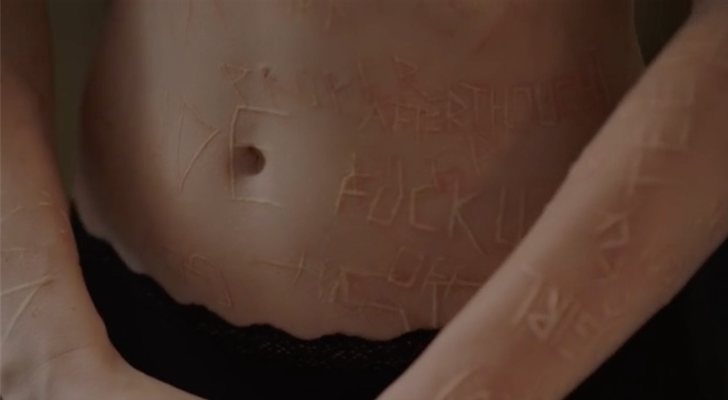 Cicatrices en el cuerpo de Amy Adams