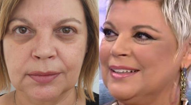 El antes y el después de Terelu Campos