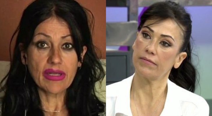 Maite Galdeano antes y después de sus retoques estéticos