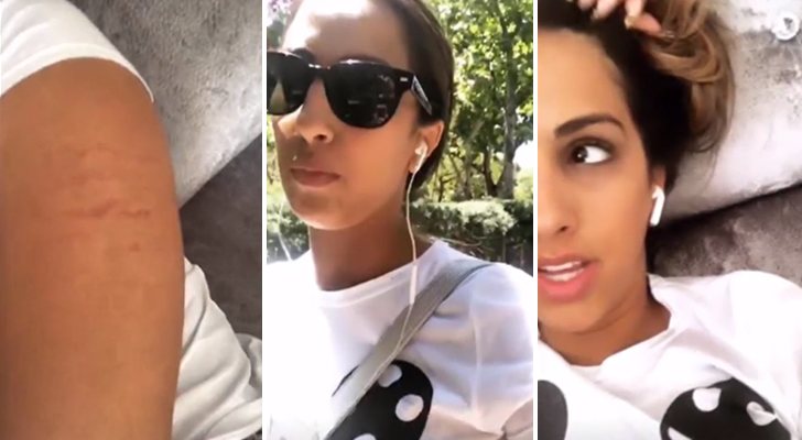 Imágenes de los stories de Noemí Salazar tras la agresión