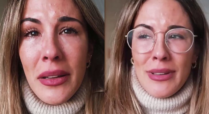 Susana Megan, tras su operación estética de ojeras