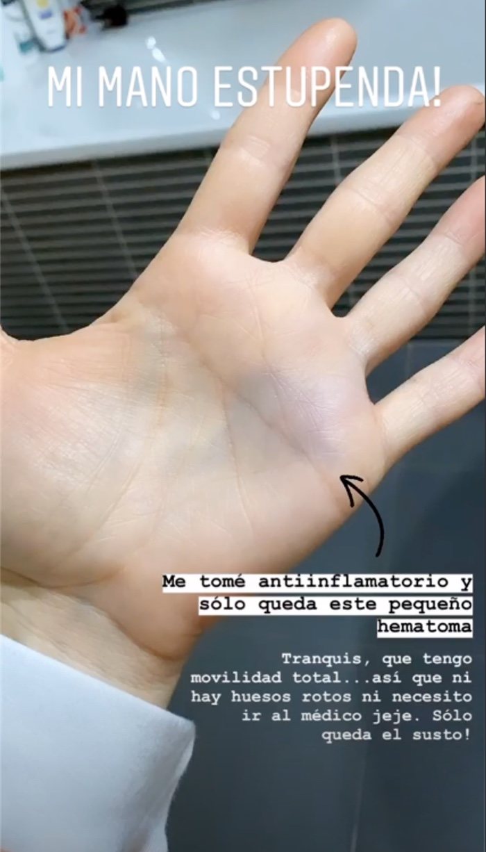 Verdeliss muestra el estado de su mano