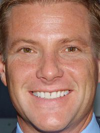 Doug Savant