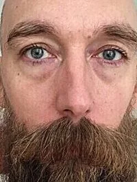 Asbjorn Krogh Nissen