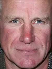 Nicholas Farrell