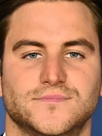 Matt Visser