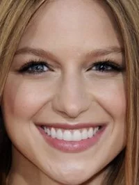 Melissa Benoist