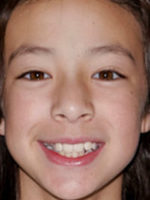 Aubrey Anderson-Emmons