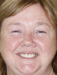 Pauline Quirke