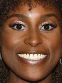 Issa Rae