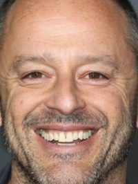 Gil Bellows