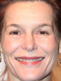 Alice Krige