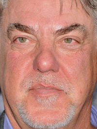 Bruce McGill