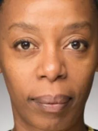 Noma Dumezweni