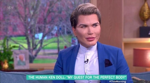 Rodrigo Alves, el Ken humano, llega a su operación 50 pero afirma "no ser adicto al quirófano"