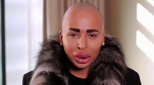 El hombre que se gastó 60.000 euros en parecerse a Kim Kardashian