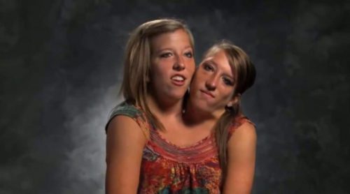 Abigail y Brittany Hensel, las gemelas siamesas en las que se inspira 'American Horror Story: Freak Show'