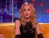 Madonna habla sobre su caída: "Me hice daño en la cabeza, no en el culo"